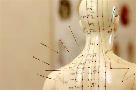 Top 10 Best Acupuncture Near Baguio, Benguet .